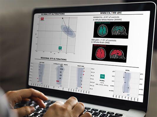 Braintale boucle une levée de fonds de 4,5M€ en série A