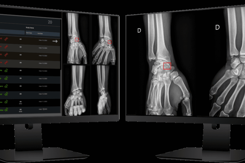 AZmed lève 15 M€ pour améliorer la radiologie grâce à l'IA