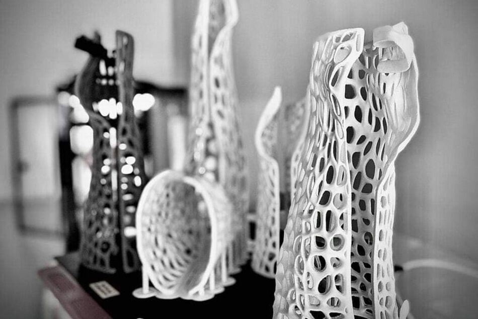 Skincasts : l'attelle imprimée en 3D pour remplacer le plâtre